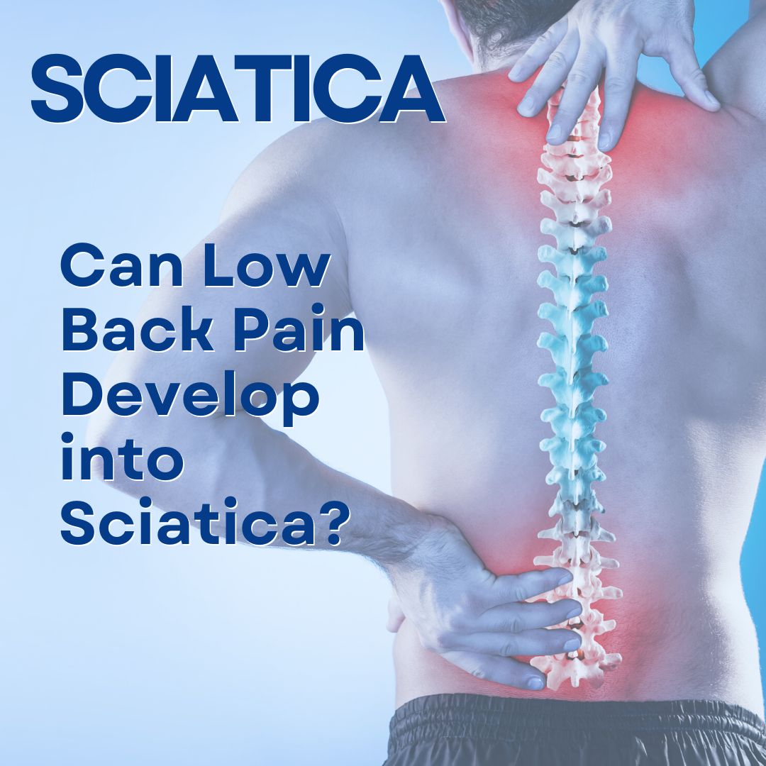 Can Low Back Pain Develop into Sciatica
