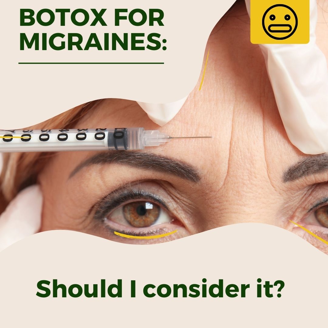 Botox for migraines: Should I consider it?